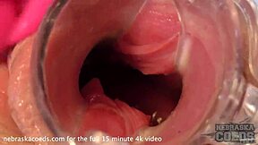 Yo, blonde Teen 18+ Sarahs Muschi mit Spekulum am Gyn geweitet, Nahaufnahme