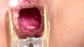 Милая венгерская девушка 18+ играет со спекулумом и дилдо для соло-фана