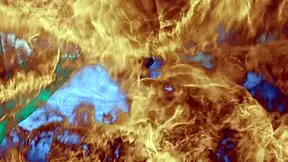 Redhead visits her plastic surgeon for a consultation involving a huge procedure