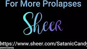 Anal overload - blowjob gapes atm atp & prolapse creampie