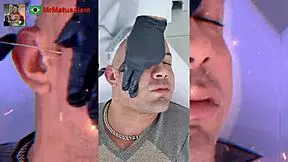 motivated by change i underwent facial harmonization and reveal the result